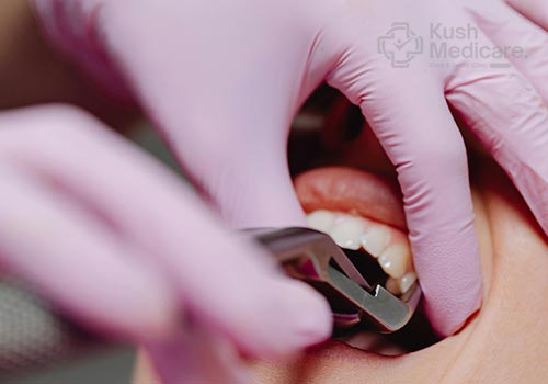 Cosmetic Fillings at KushMedicare Noida
