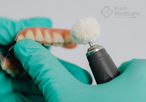 Dental Implants